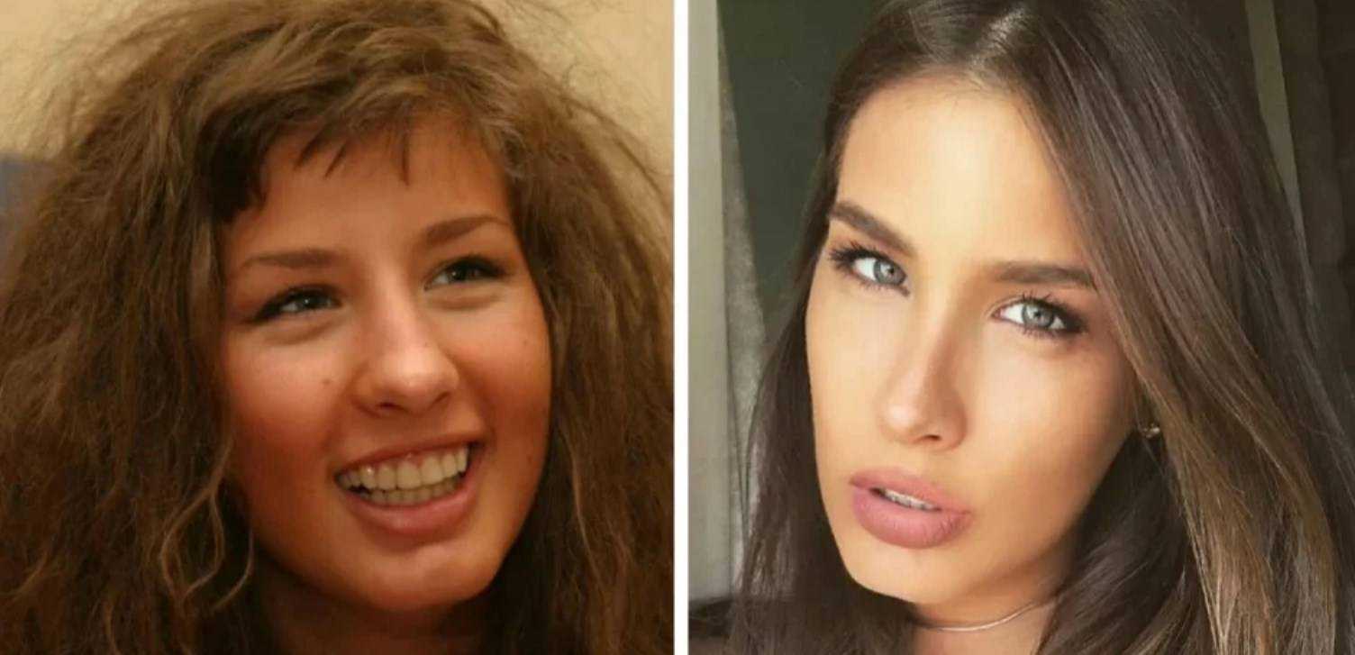 Кэти топурия до и после пластики: как изменилась внешность певицы после пластики, фотографии